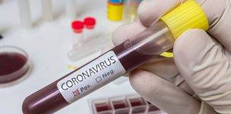 Coronavirus focolaio italiano perchè non bisogna avere paura - ricettasprint