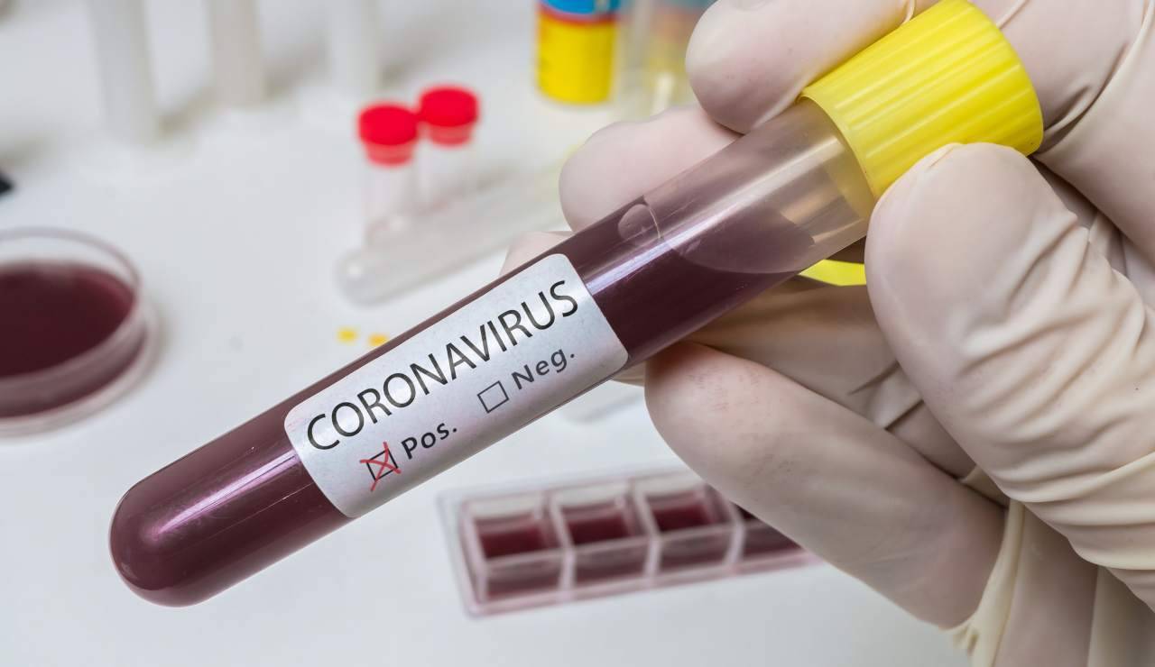 Coronavirus focolaio italiano perchè non bisogna avere paura - ricettasprint