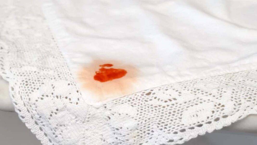Come Togliere La Cera Dalla Tovaglia