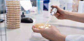 Listeria alimenti allarme
