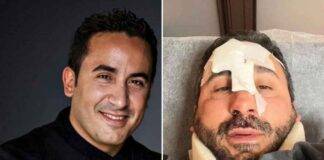 Natale Giunta incidente chef - RicettaSprint