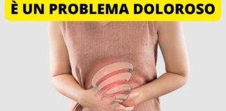 sindrome dell'intestino irritabile colon
