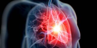 rischio infarto e ictus cibi che fanno male cosa non mangiare