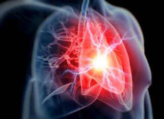 rischio infarto e ictus cibi che fanno male cosa non mangiare