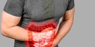 Intestino pigro, cosa mangiare per stare meglio? - RicettaSprint