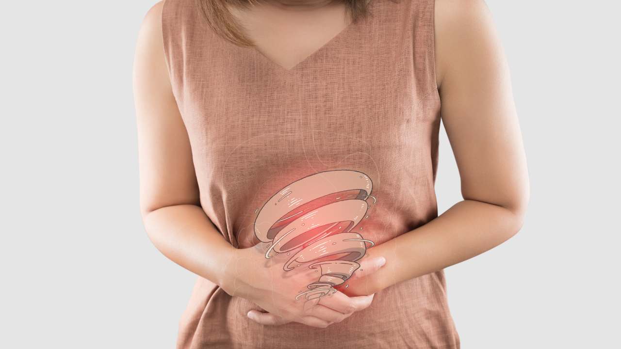 Sindrome dell'intestino irritabile sintomi e come si cura