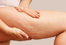 Tisana contro la cellulite - RicettaSprint
