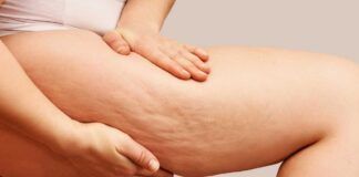 Tisana contro la cellulite - RicettaSprint