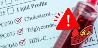 Che cosa sono colesterolo, trigliceridi alti e glicemia elevata e come farli abbassare