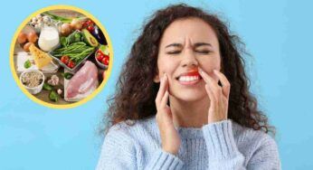 Gengive sanguinanti, risolvi il problema con questi alimenti che nella tua dieta non devono mancare mai