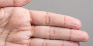 Sudorazione eccessiva e imbarazzante: trucchi per mantenere le mani asciutte