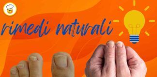 Ci ci può sbarazzare della micosi delle unghie Scopri le cause e i possibili rimedi naturali