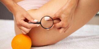 Cellulite cosa mangiare per dirle addio - RicettaSprint