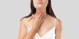 Donna reflusso gastrico