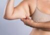 Muscoli flaccidi e cellulite alle braccia RicettaSprint