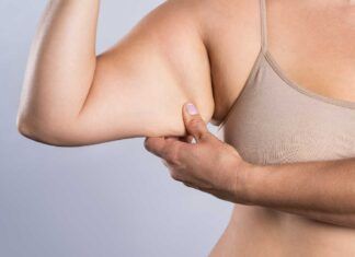 Muscoli flaccidi e cellulite alle braccia RicettaSprint