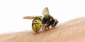 Punture api e vespe rimedi naturali - RicettaSprint