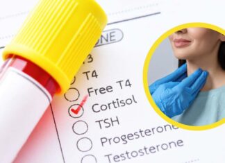 Diagnosi di cortisolo alto