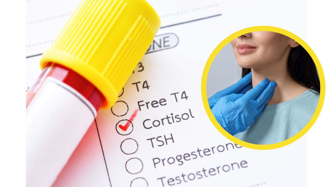 Diagnosi di cortisolo alto