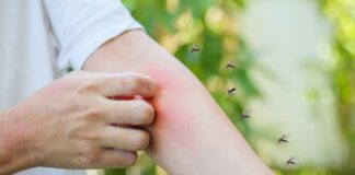 Come allontanare le zanzare RicettaSprint