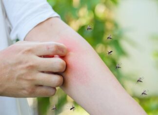 Come allontanare le zanzare RicettaSprint
