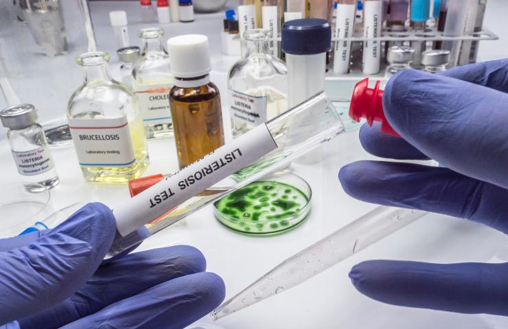 Provetta col batterio della Listeria in laboratorio