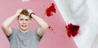 Macchie di sangue come toglierle - RicettaSprint