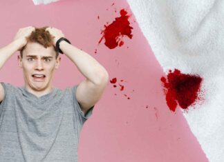 Macchie di sangue come toglierle - RicettaSprint