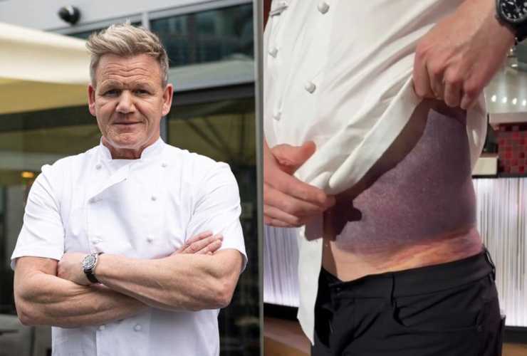 MasterChef giudice incidente rischio vita - RicettaSprint