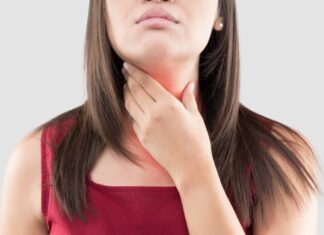Una donna con il reflusso gastrico