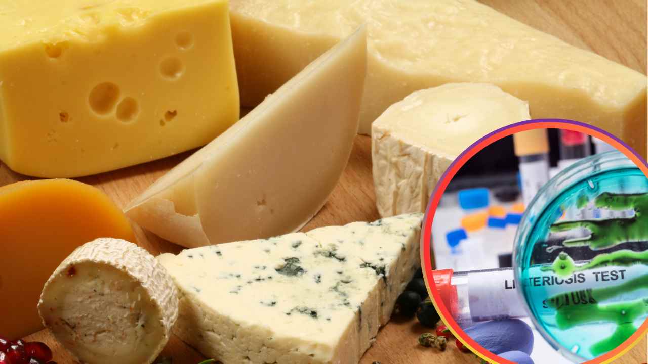 Formaggi di vario tipo ed una analisi da laboratorio sulla Listeria