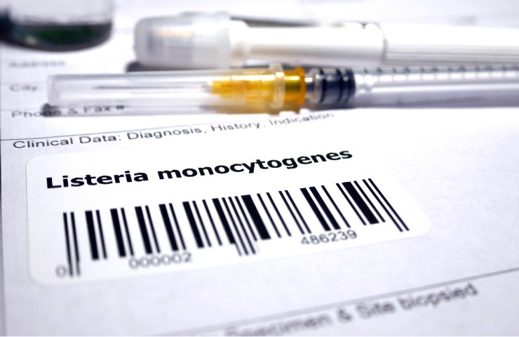 Diagnosi di Listeria monocytogenes