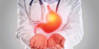 Reflusso post abbuffate di Natale, ecco come trovare sollievo reflusso post feste