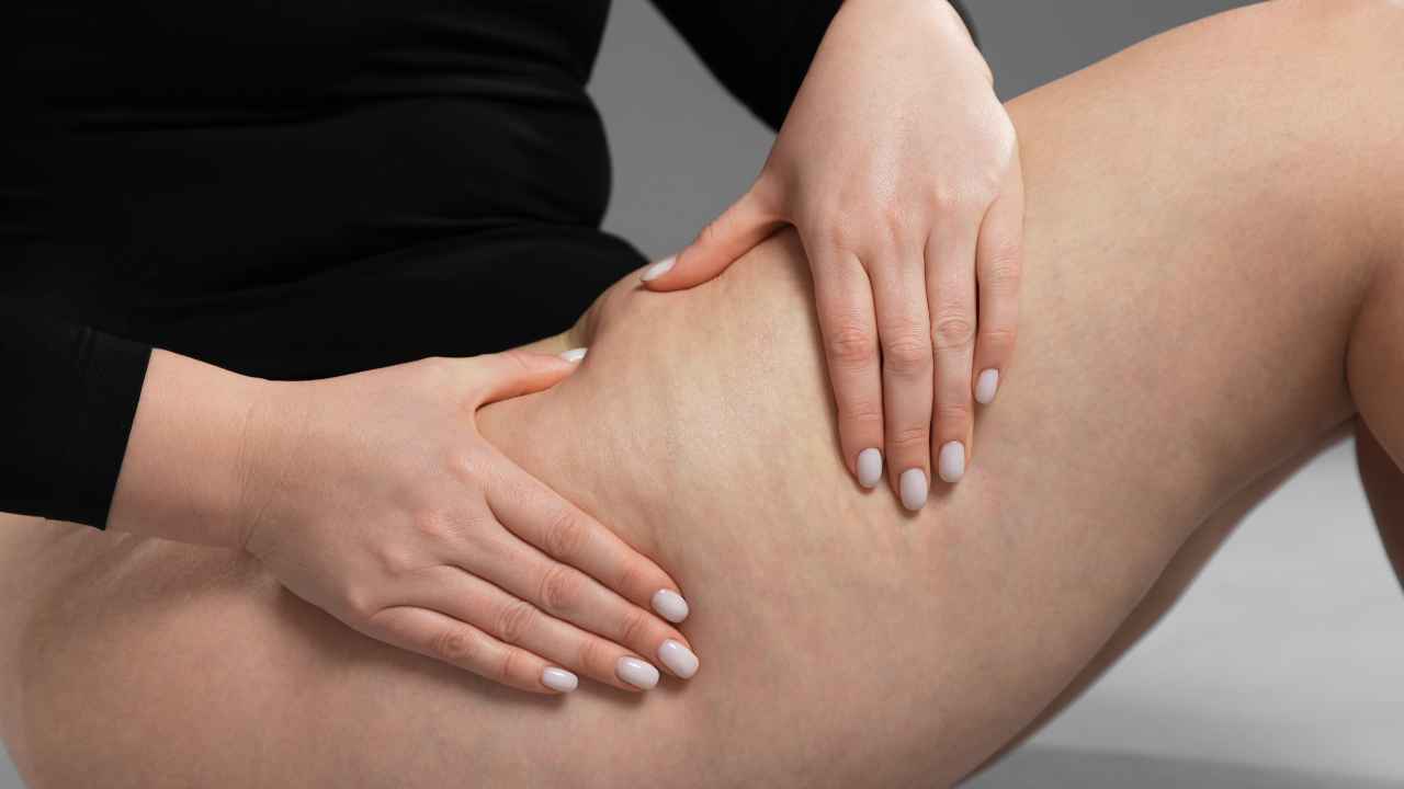 Cibi da evitare per la pelle a buccia d'arancia - RicettaSprint